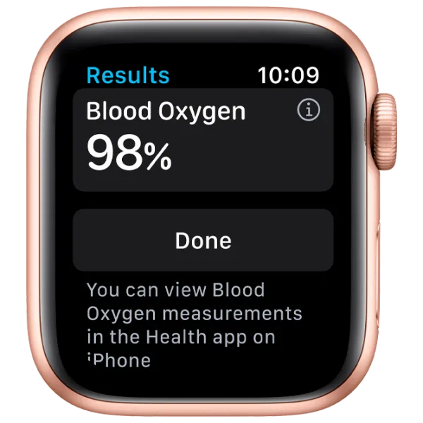 Ceas inteligent Apple Watch Series 6 1.57"/ (MG123)/ Gold photo 3 Ceas inteligent Apple Watch Series 6 1.57"/ (MG123)/ Gold photo 3