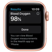 Ceas inteligent Apple Watch Series 6 1.78"/ (M00E3)/ Gold photo 3