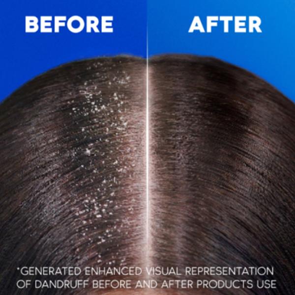 Шампунь Head & Shoulders Citrus Fresh 330 мл photo 4 Шампунь Head & Shoulders Citrus Fresh 330 мл photo 4