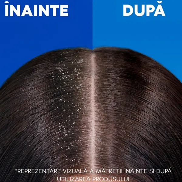 Шампунь Head & Shoulders Citrus Fresh 625 мл photo 4 Шампунь Head & Shoulders Citrus Fresh 625 мл photo 4