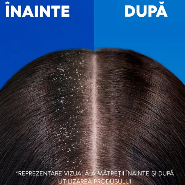 Шампунь Head & Shoulders Men Ultra Anti-Hair Fall 250 мл photo 5 Шампунь Head & Shoulders Men Ultra Anti-Hair Fall 250 мл photo 5