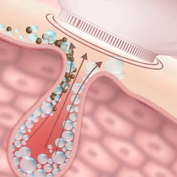 Aparat de curățare a feței Ultrasonic SK-0308 Pink photo 4