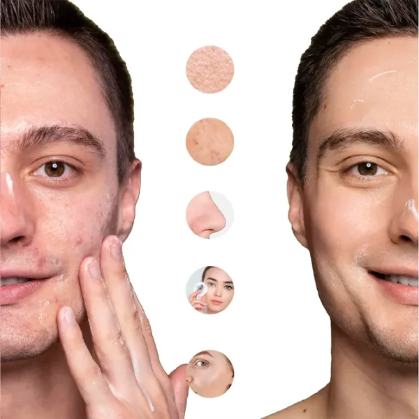 Aparat de curățare a feței Ultrasonic SK-0308 Pink photo 5