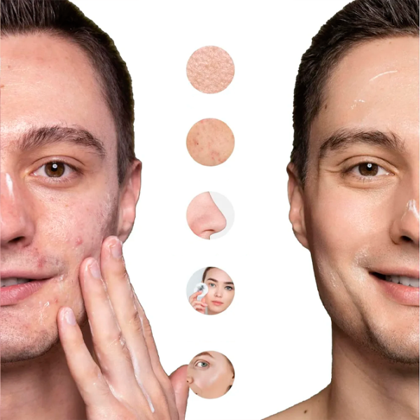 Aparat de curățare a feței Ultrasonic SK-0308 Pink photo 5