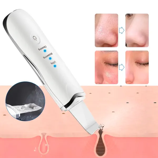 Aparat de curățare a feței Ultrasonic ZTY-0917 White photo 3