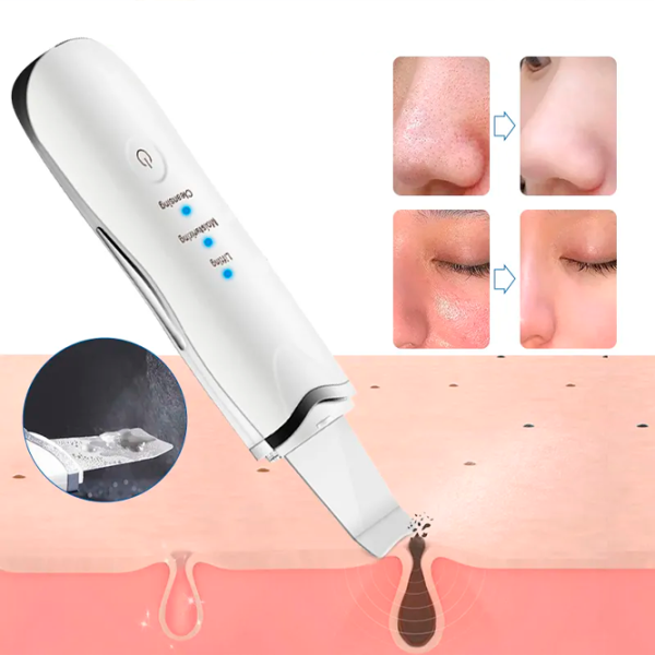 Aparat de curățare a feței Ultrasonic ZTY-0917 White photo 3