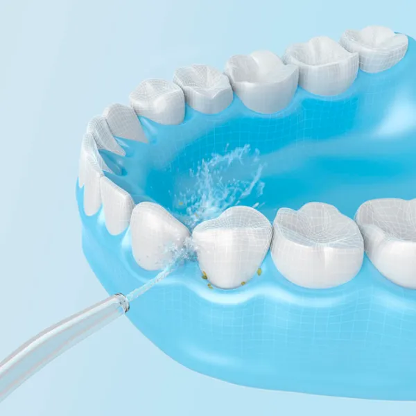 Irigator bucal Xiaomi MEO701 Cu apă sub presiune / White photo 6 Irigator bucal Xiaomi MEO701 Cu apă sub presiune / White photo 6