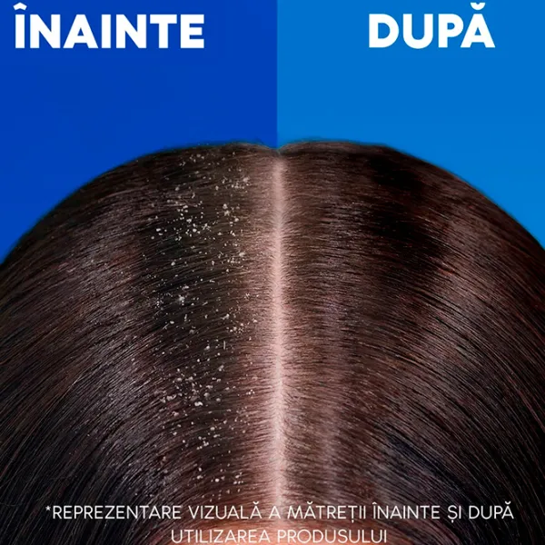 Шампунь Head & Shoulders Citrus Fresh 0.8л photo 3 Шампунь Head & Shoulders Citrus Fresh 0.8л photo 3