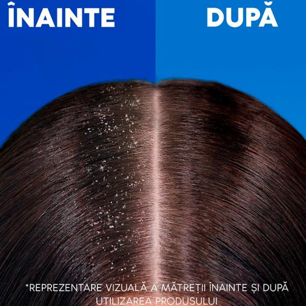 Шампунь Head & Shoulders Citrus Fresh 0.8л photo 3 Шампунь Head & Shoulders Citrus Fresh 0.8л photo 3