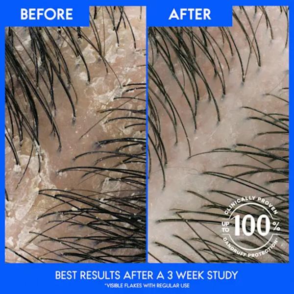Шампунь Head & Shoulders Apple Cider Vinegard 0.4л photo 4 Шампунь Head & Shoulders Apple Cider Vinegard 0.4л photo 4